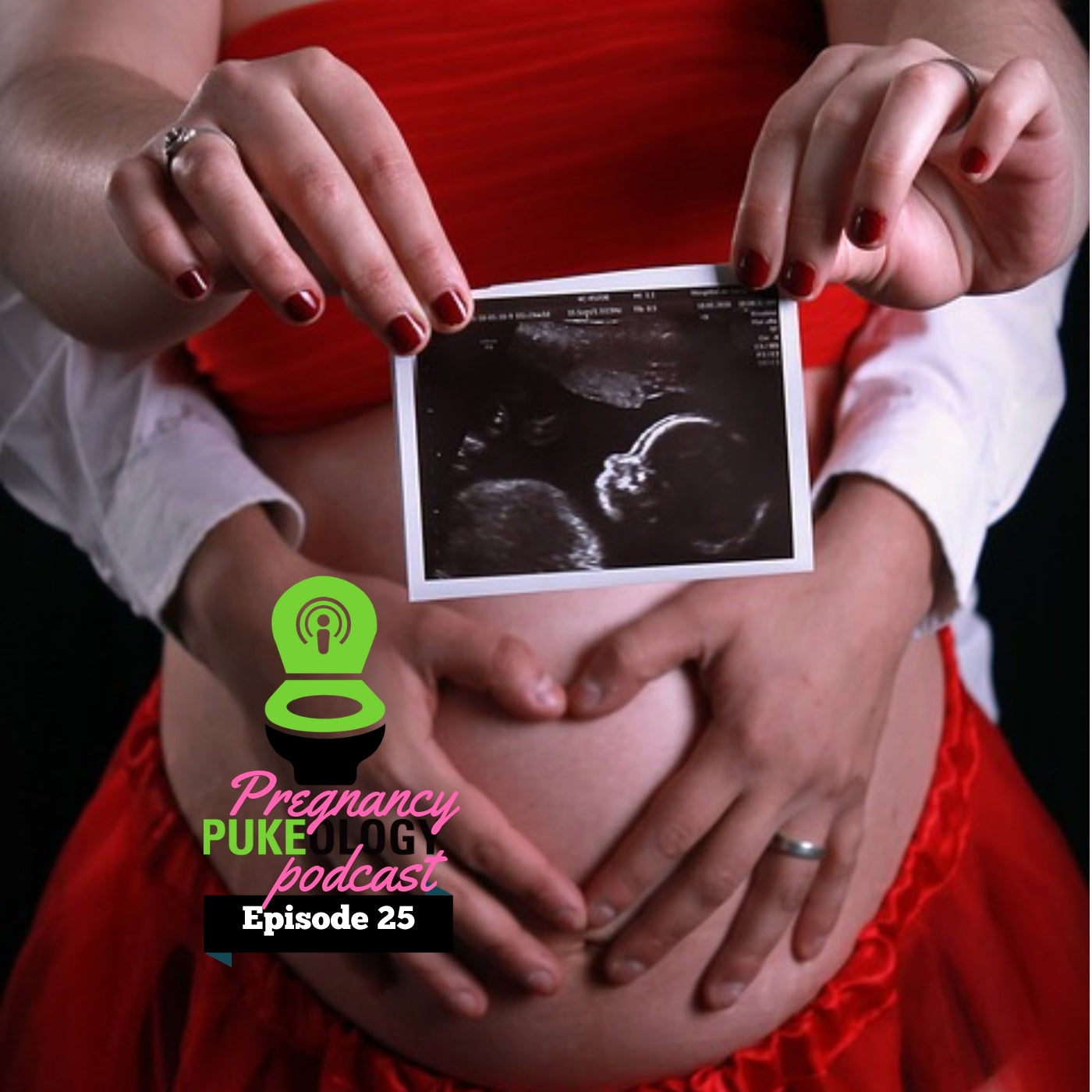 3D Ultrasound vs 4D | What is a Sonogram? - NoMoNauseaBand